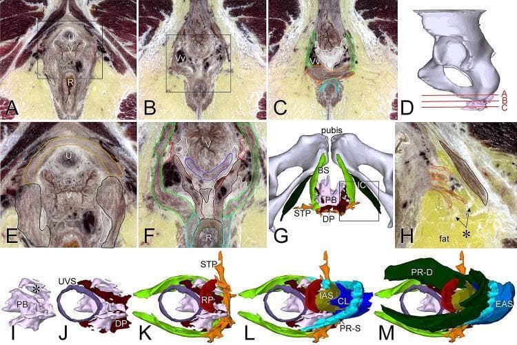 This composite educational graphic details the anatomy of the female perineal body and superficial perineal muscles through high-resolution cross-sectional imaging and 3D reconstructions. Panels A-C provide transverse sections from superior to inferior, illustrating the spatial relationship between the urethra (U), vagina (V), and rectum (R). Panel D indicates the anatomical levels of these sections relative to the pelvis. Panels E, F, and H offer magnified views highlighting muscular attachments and venous plexuses (Vv). Panel G presents an inferior 3D view of the superficial perineal region, identifying the bulbospongiosus (BS), ischiocavernosus (IC), and superficial transverse perineal (STP) muscles flanking the perineal body (PB). Panels I-M display a serial layer-by-layer 3D reconstruction of the perineal body and its complex muscular attachments, including the urethrovaginal sphincter (UVS), deep perineal muscle (DP), rectoperineal muscle (RP), internal anal sphincter (IAS), and the deep (PR-D) and superficial (PR-S) portions of the puborectal muscle. The content demonstrates the integrated structural support of the pelvic floor and the fibrous architecture of the perineal body as a central tendinous point.