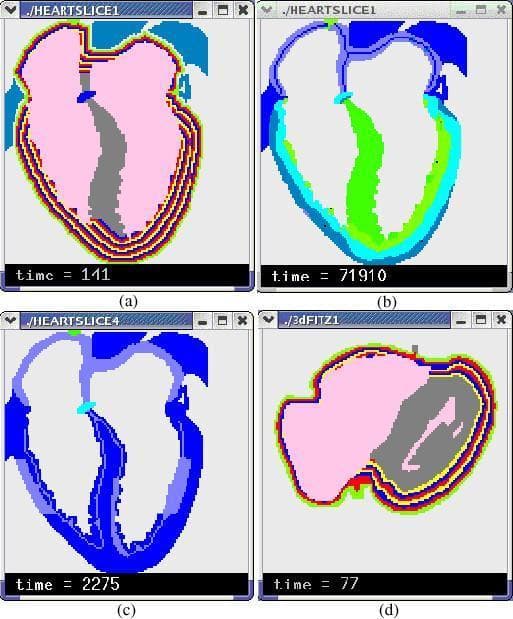 This composite image presents four panels (a–d) of computerized cardiac simulations focusing on stratified heart wall models and electrophysiological properties. Panel (a) shows a 2-D stratified heart model with multi-colored concentric layers representing the endocardium-to-epicardium transition in the ventricular walls. Panel (b) illustrates a 2-D simulation of epicardium-to-endocardium repolarization, with a color gradient (green to dark blue) mapped to transmembrane potential across the myocardium. Panel (c) highlights two areas of myocardial ischemia, visualized through variations in blue and cyan shades. Panel (d) displays a cross-sectional view of a 3-D stratified model, further demonstrating the arc-shaped fiber orientation and wall layering. The models utilize cellular automata to represent different cardiac tissues, including the sinoatrial node (SAN), atrioventricular node (AVN), and the conduction system (bundle branches and Purkinje fibers). These simulations are designed for medical education and research into arrhythmia generation, ischemia effects, and the electrical heterogeneity of the heart walls, particularly the simulation of M cells and transmural action potential duration gradients.