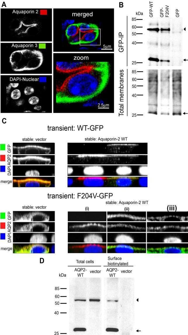 This composite image illustrates the molecular mechanisms of Aquaporin 2 (AQP2) trafficking and the rescue of the F204V mutation in Nephrogenic Diabetes Insipidus (NDI) models.
Panel A shows immunohistochemistry of kidney sections from heterozygous Aqp2 F204V/+ mice, demonstrating normal dDAVP-stimulated apical localization of AQP2 (red) relative to the basolateral marker AQP3 (green). Nuclei are counterstained with DAPI (blue).
Panel B presents a Western blot of a GFP-immunoprecipitation (GFP-IP) assay in MDCK cells, confirming a physical interaction between wild-type AQP2 and the F204V mutant protein.
Panel C displays confocal immunocytochemistry and z-sectional images of polarized MDCK cells. It compares the localization of transiently transfected WT-GFP and F204V-GFP. While F204V-GFP is cytoplasmic/perinuclear in vector-only cells, it shows rescued apical surface localization when co-expressed with stable AQP2-WT.
Panel D provides biochemical evidence via surface biotinylation, showing that AQP2-F204V is only present at the cell surface when co-expressed with wild-type AQP2, supporting a 'piggy-back' rescue mechanism relevant to heterozygous clinical phenotypes.