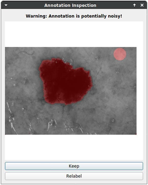 This clinical photograph, presented within a dermatological software interface, depicts a suspicious skin lesion, likely a melanoma, being analyzed for diagnostic segmentation. The primary lesion is a dark red, irregularly shaped macule with jagged, poorly defined borders and a heterogeneous surface texture. It is set against a background of lighter grayish-white skin. The image demonstrates a post-annotation inspection phase in a deep learning workflow. Two distinct red transparent overlays (annotations) are visible: a large, central segment conforming to the primary lesion and a secondary, small circular artifact in the upper right quadrant. A system notification at the top of the GUI displays a 'Warning: Annotation is potentially noisy!', triggered by the detection of multiple segmented objects when only one clinical entity (the lesion) is expected. This visual illustrates the quality control and data cleaning process essential for medical image processing and the training of diagnostic algorithms in dermatology.
