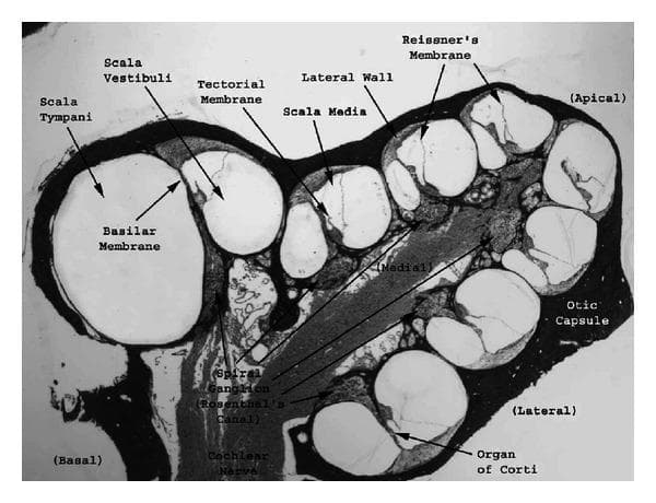 This medical micrograph illustrates a plastic cross-section of a guinea pig cochlea, viewed in a near midmodiolar plane to reveal the anatomy of the inner ear. The cochlea is presented as a coiled labyrinth within the bony otic capsule, showing approximately 2.5 turns from the basal to the apical region. Each turn exhibits three distinct fluid-filled chambers: the scala vestibuli (superior), the scala media (middle), and the scala tympani (inferior). Key anatomical landmarks are labeled, including Reissner's membrane, which serves as the boundary between the scala vestibuli and scala media, and the basilar membrane, which separates the scala media from the scala tympani. The organ of Corti is visible sitting upon the basilar membrane, with the overlying tectorial membrane. Central neural structures are clearly identifiable, specifically the spiral ganglion within Rosenthal's canal and the cochlear nerve fibers. This image serves as a fundamental anatomical reference for auditory physiology and the study of mechanical-to-electrical transduction within the mammalian hearing system.