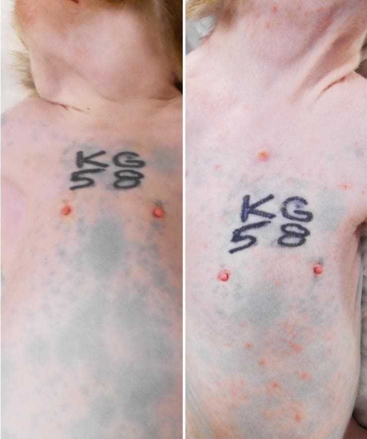 A comparative side-by-side clinical photograph illustrating the progression of primary varicella (chickenpox) rash in a rhesus macaque model. The left panel shows the baseline pre-inoculation state, displaying clear skin on the neck, torso, and abdomen with normal anatomical markings and identifying tattoos. The right panel, captured at 9 days post-inoculation (dpi), demonstrates a severe, generalized acute skin rash. The morphology of the lesions includes a dense distribution of small, erythematous (reddish/pinkish) macules and papules. The rash is widespread, involving the neck, shoulders, chest, and ventral abdomen. This comparison serves to highlight the clinical manifestation of Simian Varicella Virus (SVV), which mirrors the presentation of Varicella-Zoster Virus (VZV) in humans, focusing on the density, distribution, and characteristic appearance of primary varicella lesions.