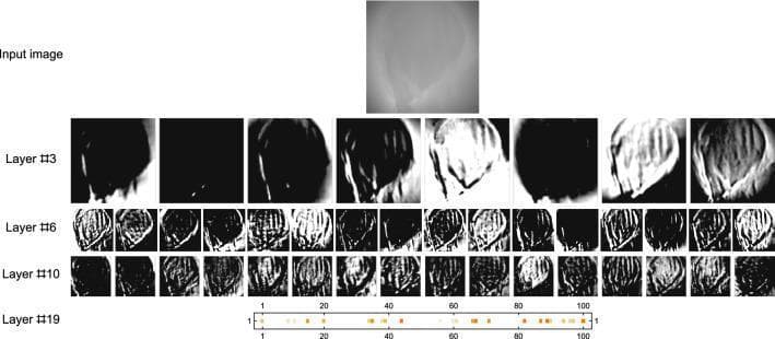 This technical diagram illustrates the internal feature extraction process of a convolutional neural network (CNN) used for forensic age estimation based on 3D scans of the human pubic symphysis. The image follows the evaluation of a 72-year-old individual through various processing stages. The 'Input image' shows a grayscale 2D projection of the 3D surface scan, appearing as a blurry anatomical outline. Subsequent rows visualize internal network layers: Layer #3 shows initial filters focusing on high-contrast edges and basic morphology; Layers #6 and #10 display multiple feature maps that refine complex textures and vertical ridge patterns characteristic of age-related skeletal degeneration. The final row, Layer #19, depicts a one-dimensional feature vector represented as a linear scale (1–100) with colored activation points, indicating the condensed high-level data used for the final age prediction (estimated here as 71.6 years). This visualization demonstrates how AI identifies subtle morphological changes in skeletal remains that may be difficult for the human eye to quantify, providing a specialized tool for forensic anthropology and clinical aging research.