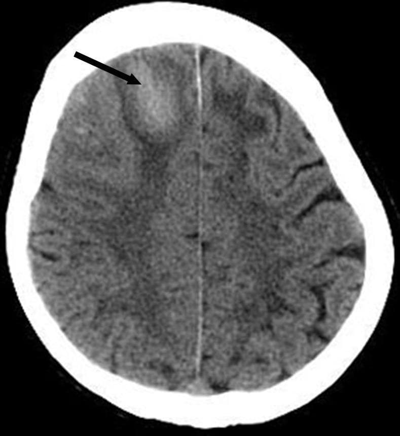 Hugging Face pmc clinical VQA raw