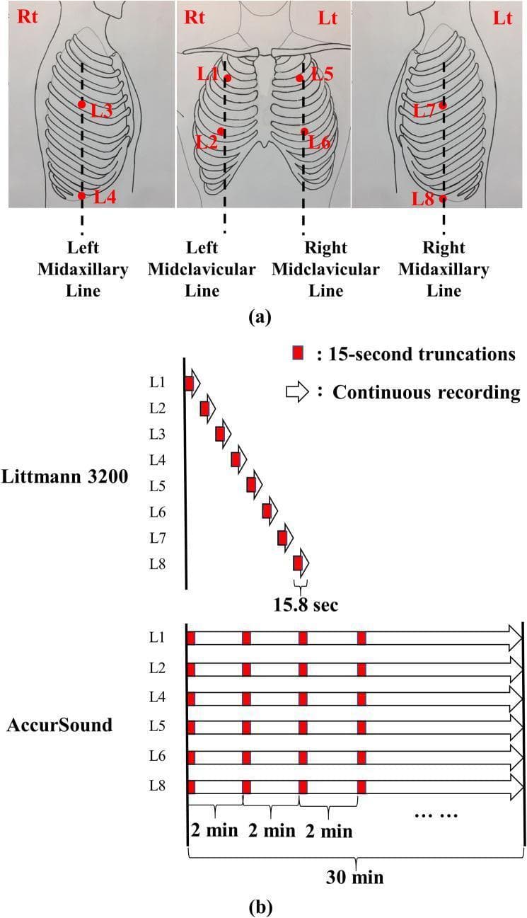 This educational graphic illustrates standardized auscultation locations and lung sound recording protocols. Panel (a) presents anatomical diagrams of the thorax showing eight specific auscultation points (L1–L8). Right-side locations include the second intercostal space (ICS) on the midclavicular line (L1), the fifth ICS on the midclavicular line (L2), the fourth ICS on the midaxillary line (L3), and the tenth ICS on the midaxillary line (L4). Left-side locations (L5–L8) mirror these positions. Panel (b) compares two digital recording methodologies. The Littmann 3200 protocol demonstrates a sequential approach, capturing 15.8-second recordings from L1 through L8 one by one. In contrast, the AccurSound (HF-Type-1) protocol depicts a simultaneous multi-channel approach, recording from six locations (L1, L2, L4, L5, L6, L8) concurrently for a continuous 30-minute duration. The diagram highlights how these recordings are truncated into 15-second segments for analysis. This visual is designed to explain standardized pulmonary physical examination techniques and data acquisition for digital stethoscopes.