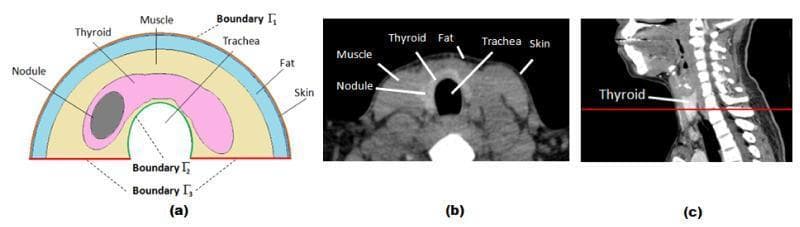 This composite educational graphic details the cross-sectional anatomy of the human neck for Finite Element (FE) thyroid simulation. (a) A 2D schematic diagram presents a simplified semicircular model of the neck. It labels the layers concentrically: skin (outermost), fat, and muscle. Inside the muscle layer, the thyroid gland is depicted in pink, containing an elliptical dark grey thyroid nodule. Boundaries are marked as Γ1 (skin surface), Γ2 (trachea boundary), and Γ3 (prescribed temperature base). (b) A corresponding axial CT scan image shows the actual anatomical cross-section, with labels identifying the skin, fat, muscle, thyroid gland, trachea (central air-filled void), and an internal nodule. The CT highlights varying tissue densities, from the dark fat layer to the intermediate density of muscle and thyroid tissue. (c) A sagittal CT view of the head and neck shows a red horizontal line indicating the anatomical plane of the axial slice in (b), positioned at the level of the thyroid gland. This visual serves as a reference for modeling heat transfer and infrared thermography in patients with thyroid nodules.