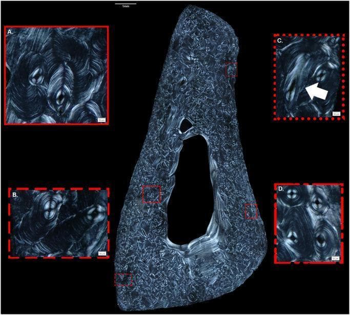 This diagnostic image displays a polarized light microscopic thin section of a human male fibula, focusing on cortical bone microarchitecture and osteon morphotypes. The central large-scale image shows a transverse cross-section of the fibula with a distinct medullary cavity. Four high-magnification insets (A-D) illustrate specific histological features. Inset A and B demonstrate drifting osteons (DOs), characterized by a trailing hemicyclical tail of lamellae behind the Haversian canal, following irregular or linear pathways. Inset C uses an arrow to identify an oblique osteonal canal, highlighting a common visual confounder that can mimic drifting morphology due to the angle of the cut. Inset D displays typical secondary osteons with characteristic concentric lamellae and centrally located Haversian canals. This material is used in forensic anthropology and bone histology to study skeletal remodeling, aging, and taxonomic differentiation, specifically demonstrating how specialized osteon structures like DOs can assist in identifying human bone fragments based on remodeling rates and cortical area analysis.