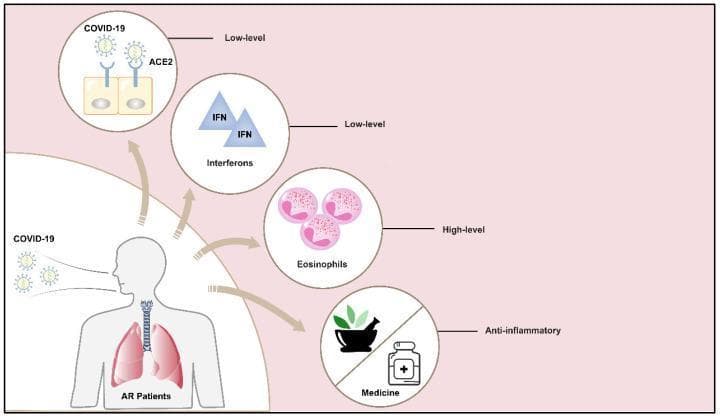 This medical infographic illustrates the pathophysiological landscape of Allergic Rhinitis (AR) in the context of COVID-19 susceptibility. A central human figure representing an AR patient is shown inhaling COVID-19 viral particles. Four circular callouts detail specific immunological and pharmacological factors influencing disease outcomes. The diagram highlights that AR patients exhibit 'low-level' ACE2 receptors on epithelial cells and 'low-level' Interferons (IFN), both of which are factors that may limit viral entry and replication. Conversely, the image depicts 'high-level' eosinophils, which are noted for their protective role in antiviral host defense. The final callout represents treatment strategies, labeled 'Anti-inflammatory Medicine,' featuring icons of a mortar and pestle with botanicals alongside a medical bottle, reflecting the use of both inhaled corticosteroids and traditional medicine. The illustration serves as an educational summary of why patients with allergic rhinitis might experience different susceptibility or severity levels when infected with SARS-CoV-2.