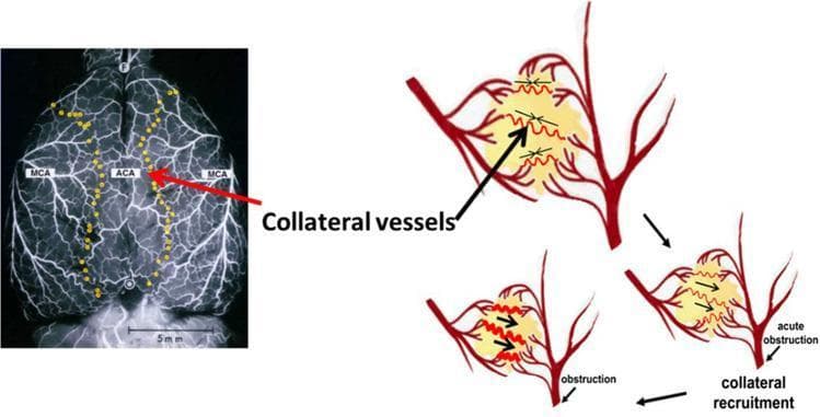 This composite educational image illustrates the anatomy and pathophysiology of cerebral collateral recruitment. On the left, a dorsal view of a rat brain angiogram displays the arterial network, specifically labeling the middle cerebral arteries (MCA) and the anterior cerebral artery (ACA). Yellow markers delineate leptomeningeal anastomoses (LMAs) located at the watershed territories where these distal arterial branches meet. A 5mm scale bar is provided for anatomical context. On the right, a three-part schematic diagram illustrates the mechanism of collateral flow recruitment following an acute obstruction (e.g., ischemic stroke). The top diagram shows normal perfusion where collaterals have no net flow. The subsequent diagrams show that after an arterial occlusion occurs, pressure gradients drive blood through these anastomotic channels. Red zigzag lines represent the opening and dilation of collateral vessels, with black arrows indicating the redirection of blood flow into the ischemic territory. This figure demonstrates how preexisting collateral circulation acts as a compensatory mechanism to maintain cerebral blood flow during arterial blockage.