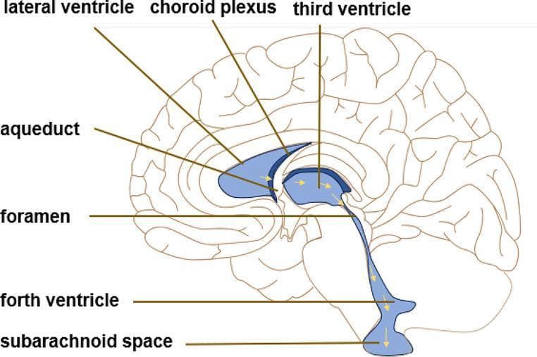 An anatomical diagram of the human brain in sagittal section, illustrating the classical theory of cerebrospinal fluid (CSF) circulation. The ventricular system is highlighted in light blue, and yellow arrows indicate the directional flow of CSF. Labeled structures include the lateral ventricle, choroid plexus (site of CSF secretion), third ventricle, interventricular foramen, cerebral aqueduct, fourth ventricle, and the subarachnoid space. The diagram depicts the sequential pathway starting from the lateral ventricles, passing through the foramen to the third ventricle, continuing through the narrow aqueduct into the fourth ventricle, and finally exiting into the subarachnoid space surrounding the central nervous system. This educational illustration serves to teach the physiological movement of CSF and the anatomical relationships within the brain's ventricular system, relevant to clinical topics such as obstructive and communicating hydrocephalus.