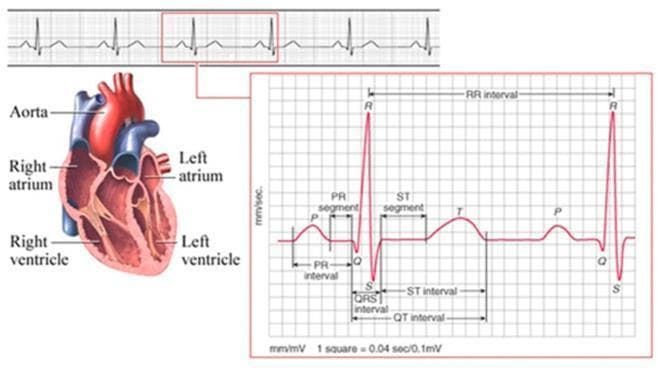This composite educational illustration combines an anatomical diagram of the human heart with a diagnostic Electrocardiogram (ECG) tracing to demonstrate cardiac physiology. On the left, a coronal cross-section of the heart identifies the Aorta, Right Atrium, Left Atrium, Right Ventricle, and Left Ventricle. The right side features a detailed ECG waveform analysis set against a standard measurement grid (1 square = 0.04 sec / 0.1 mV). The tracing identifies key electrophysiological components: the P wave (atrial depolarization), QRS complex (ventricular depolarization), and T wave (ventricular repolarization). Critical diagnostic intervals and segments are explicitly labeled, including the PR interval, PR segment, QRS interval, ST segment, ST interval, QT interval, and the RR interval (representing the heart rate). This comparison chart and pathophysiology diagram serve as an introductory resource for understanding the correlation between cardiac anatomy and the electrical signals recorded during a cardiac cycle, suitable for basic to intermediate medical education.