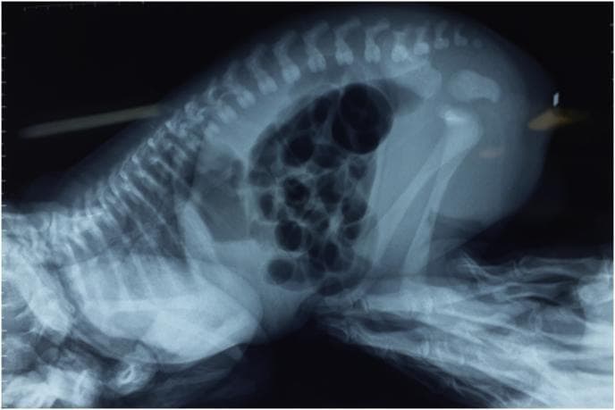 This diagnostic image is a cross-table lateral X-ray of a newborn infant in a prone position, often referred to as an invertogram or Wangensteen-Rice view. The imaging primary focus is the evaluation of anorectal malformations (ARM). The skeletal system is clearly visible, showing the vertebral column with individual vertebrae and spinous processes, the rib cage, and the pelvic girdle comprising the ilium, ischium, and pubis. The femur and tibia of the lower extremities are flexed. The abdomen contains multiple radiolucent (dark) air-filled bowel loops. A key diagnostic feature is the distance between the most distal gas bubble in the rectum and the perineal skin (often marked with a radiopaque marker), used to determine the level of the atresia (high, intermediate, or low). This clinical imaging modality is essential for surgical planning in neonates presenting with imperforate anus to differentiate between various types of anorectal anomalies and associated fistulas.