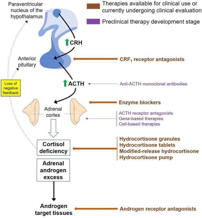 This pathophysiology diagram illustrates the hypothalamic-pituitary-adrenal (HPA) axis in the context of Congenital Adrenal Hyperplasia (CAH) and its pharmacological targets. The central pathway shows the paraventricular nucleus of the hypothalamus releasing CRH to stimulate the anterior pituitary, which then secretes ACTH. In CAH, 21-hydroxylase deficiency leads to cortisol deficiency, causing a loss of negative feedback and subsequent ACTH elevation. This drive results in adrenal androgen excess affecting target tissues. Therapeutic interventions are categorized by development stage: Clinical-stage therapies (brown labels) include CRF1 receptor antagonists, various hydrocortisone delivery methods (granules, tablets, modified-release, and pumps), and androgen receptor antagonists. Preclinical therapies (purple labels) include anti-ACTH monoclonal antibodies, enzyme blockers, ACTH receptor antagonists, and gene- or cell-based therapies. The diagram highlights the strategy of mitigating androgen excess by either replacing cortisol to restore feedback or directly inhibiting signaling at various levels of the axis.