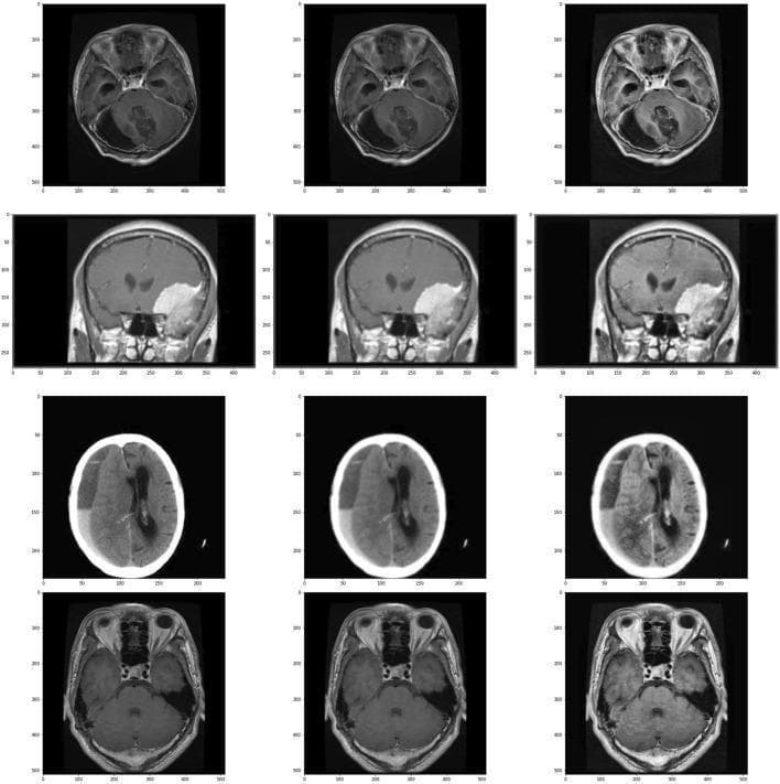 A comparison chart showcasing medical neuroimaging preprocessing stages for brain tumor classification. The grid displays four clinical cases (rows) across three imaging states (columns). Column 1 shows original axial and coronal diagnostic images, including MRI and CT modalities. Column 2 demonstrates the application of a Gaussian blur for noise reduction, resulting in softened edges. Column 3 displays the final stage using Contrast Limited Adaptive Histogram Equalization (CLAHE) to enhance local contrast and edge definition of pathological features. The rows categorize specific conditions: Row 1 illustrates a glioma with associated mass effect; Row 2 shows a large, hyperintense meningioma with distinct borders; Row 3 represents a 'no tumor' control case showing normal neuroanatomy or non-neoplastic changes; and Row 4 depicts a pituitary tumor located in the sellar region. This visual is designed for medical AI and radiology education, focusing on image enhancement techniques to improve the detection and differentiation of intracranial neoplasms.