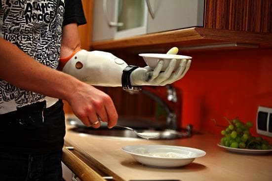 This clinical photograph demonstrates the use of an upper-limb myoelectric prosthesis during Activities of Daily Living (ADLs). The image shows a patient with a transradial (below-elbow) amputation performing a kitchen-related task. The prosthesis features a white or off-white forearm casing that fits over the residual limb, secured by a black wristband-style interface. The terminal device is an articulated prosthetic hand with anatomical finger modeling, shown here providing a stable platform and grip to hold a bowl. The patient's contralateral intact hand is using a spoon, illustrating the coordinated bimanual function and stabilization that prosthetic rehabilitation aims to achieve. Educational concepts include prosthetic fitting, functional rehabilitation post-amputation, and the integration of assistive devices into daily life. The image is relevant to orthopedic surgery, physical medicine and rehabilitation (PM&R), and occupational therapy.
