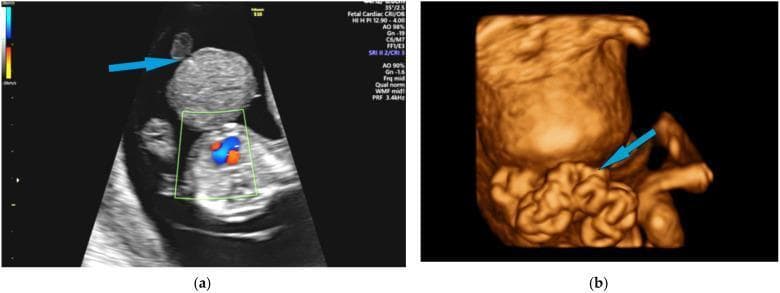 Hugging Face pmc clinical VQA raw