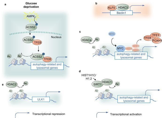 A multi-panel pathophysiology diagram illustrating the epigenetic regulation of autophagy via histone acetylation and deacetylation. (a) Under glucose deprivation, AMPK phosphorylates ACSS2, promoting its nuclear translocation; ACSS2 binds TFEB to facilitate histone H3 acetylation (Ac) at autophagy and lysosomal gene promoters, leading to transcriptional activation. (b) KLF5 and HDAC3 bind the Beclin1 promoter, resulting in transcriptional repression. (c) MYC and Class I HDACs cooperatively repress autophagy-related and lysosomal genes by removing acetylation marks and displacing transcription factors like TFEB, TFE3, and FOXH1. (d) Linker histone HIST1H1C/H1.2 upregulates SIRT1 and HDAC1 to maintain H4K16 deacetylation, which paradoxically leads to ATG protein expression and autophagy promotion. (e) HDAC2 activity on the ULK1 promoter maintains deacetylation; reduction in HDAC2 leads to increased H3K27 acetylation but correlates with reduced ULK1 expression in specific clinical contexts like diabetic renal fibrosis. The diagram uses blue arrows to denote transcriptional activation and right-angled arrows to denote repression, highlighting the diverse roles of histone-modifying enzymes in cellular homeostasis.