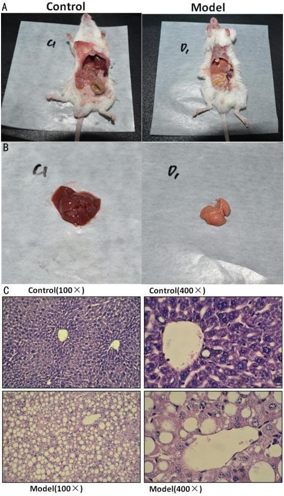 Educational panel illustrating the macroscopic and microscopic pathology of Nonalcoholic Steatohepatitis (NASH) in a mouse model. Panel A presents the gross anatomy of dissected control and model mice. Panel B provides a high-resolution clinical photograph comparing a healthy control liver (dark red/brown, smooth surface) with a NASH model liver (pale yellow-tan, suggestive of steatosis and atrophy). Panel C displays diagnostic histopathology using Hematoxylin and Eosin (H&E) staining at 100x and 400x magnifications. The control group micrographs show normal hepatocyte architecture with organized cords and clear sinusoidal spaces. In contrast, the NASH model micrographs demonstrate hallmark features of hepatic steatosis, including diffuse macrovesicular and microvesicular fat deposition, hepatocyte ballooning, and cellular disarray. The 400x magnification specifically highlights large, clear vacuoles within the cytoplasm of hepatocytes, which displace the nuclei to the periphery. This comparison serves as a diagnostic reference for metabolic liver disease research and pathological classification.