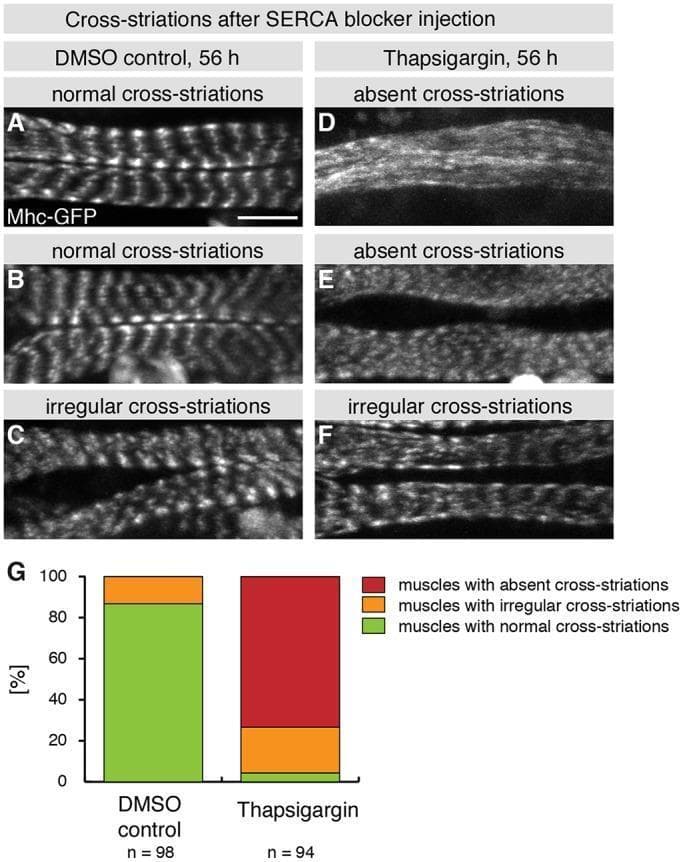 This composite educational graphic details the role of muscle contractions in myofibril sarcomerogenesis using a Drosophila model. The visual combines fluorescence microscopy and quantitative data analysis. Panels A-F show Mhc-GFP (Myosin Heavy Chain-Green Fluorescent Protein) expression in muscles 56 hours after puparium formation (APF). Panels A-C represent the DMSO control group, showing highly organized, periodic banding patterns typical of 'normal cross-striations' and some 'irregular cross-striations.' Panels D-F show muscles injected with Thapsigargin (a SERCA inhibitor), demonstrating a marked disruption of sarcomere assembly, labeled as 'absent cross-striations' or 'irregular cross-striations' characterized by a loss of distinct lateral alignment and periodicity. Panel G is a stacked bar graph quantifying these phenotypes: the control group (n=98) exhibits approximately 87% normal striations, while the Thapsigargin group (n=94) shows roughly 73% absent striations. The figure demonstrates the clinical and biological importance of calcium-induced mechanical tension and contractions in the maturation of striated muscle architecture.