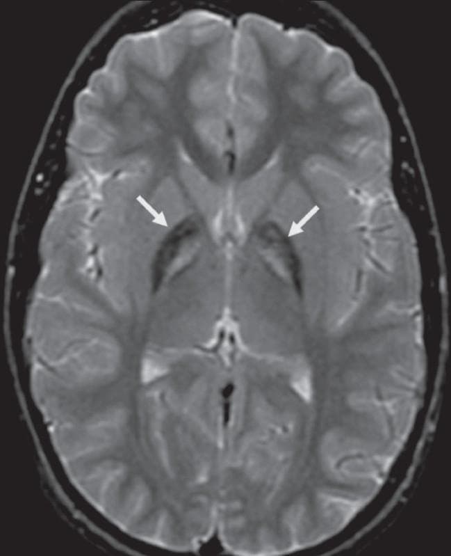 Hugging Face pmc clinical VQA raw