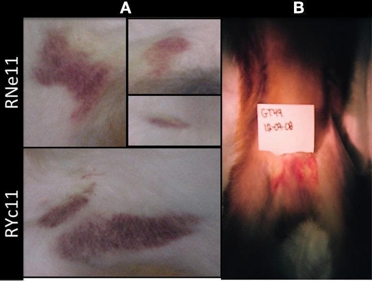 Clinical photograph presenting cutaneous manifestations of Dengue Virus 2 (DV2) infection in a rhesus macaque animal model, serving as a surrogate for human hemorrhagic fever pathology. The image is divided into two primary panels illustrating hematomas and ecchymoses. Panel A displays localized skin lesions on Indian rhesus macaques (labeled RNe11 and RYc11) at Day 7 post-infection. These lesions appear as dark reddish-purple, irregular patches (ecchymoses) and deeper, raised areas of blood accumulation (hematomas). The morphology ranges from diffuse, blotchy purpura to elongated, streak-like hemorrhagic patterns. Panel B shows a Chinese rhesus macaque (GT49) at Day 6 post-infection, highlighting localized hemorrhaging in the perineal region. This area exhibits a patchy distribution of erythema and subcutaneous bleeding against a background of light-colored fur. The visual data demonstrates the clinical spectrum of vasculopathy and coagulopathy associated with acute flavivirus infection, specifically modeling the capillary leak and hemorrhagic tendencies observed in human Dengue Hemorrhagic Fever (DHF).