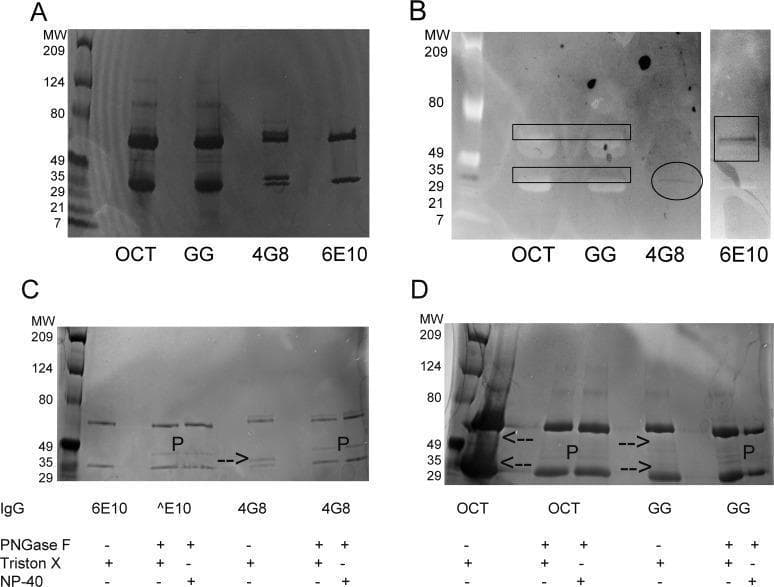 This composite diagnostic image features biochemical analysis of Intravenous Immunoglobulin (IVIG) products and monoclonal antibodies (4G8 and 6E10) using SDS-PAGE and lectin blotting to characterize protein structure and sialylation.
Panel A shows an SDS-PAGE gel identifying light chain (IgGL, ~25 kD) and heavy chain (IgGH, ~50 kD) bands. IVIG samples (OCT, GG) display more complex, diffuse banding compared to the simpler patterns of 4G8 and 6E10.
Panel B presents an SNA lectin blot indicating sialic acid distribution. Dark staining highlights sialylation on both chains for IVIG (rectangles), primarily on the Fab-associated light chain for 4G8 (circle), and exclusively on the Fc-associated heavy chain for 6E10 (square).
Panels C and D demonstrate the effect of PNGase F treatment, which removes N-linked glycans. Arrows indicate specific bands (slower-migrating light chains in 4G8 and IVIG) that disappear or shift after deglycosylation, confirming the presence of Fab-domain glycosylation. The 'P' label marks the PNGase F enzyme at 36 kD. These findings provide insight into the differential glycosylation of therapeutic antibodies and polyclonal IgG used in clinical immunology.