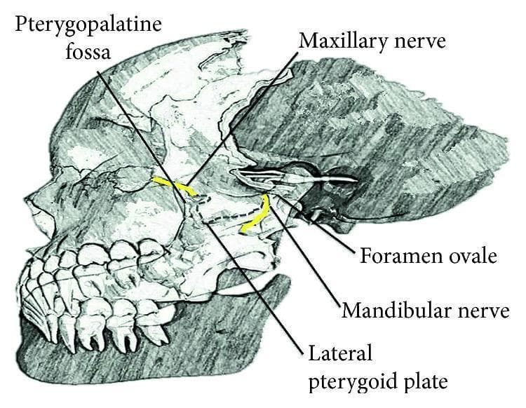 Anatomical diagram of a lateral view of the human skull, specifically focusing on the deep facial nerves and related osteological landmarks. The illustration highlights the trigeminal nerve (CN V) divisions using yellow color-coding. The maxillary nerve (V2) is shown exiting the cranial cavity through the foramen rotundum to enter the pterygopalatine fossa, located anterior to the lateral pterygoid plate. The mandibular nerve (V3) is depicted exiting via the foramen ovale, descending posterior to the lateral pterygoid plate. Key labels include the Pterygopalatine fossa, Maxillary nerve, Foramen ovale, Mandibular nerve, and Lateral pterygoid plate. The diagram serves as an educational resource for understanding the regional anatomy required for performing nerve blocks and identifying neural pathways within the infratemporal and pterygopalatine regions.
