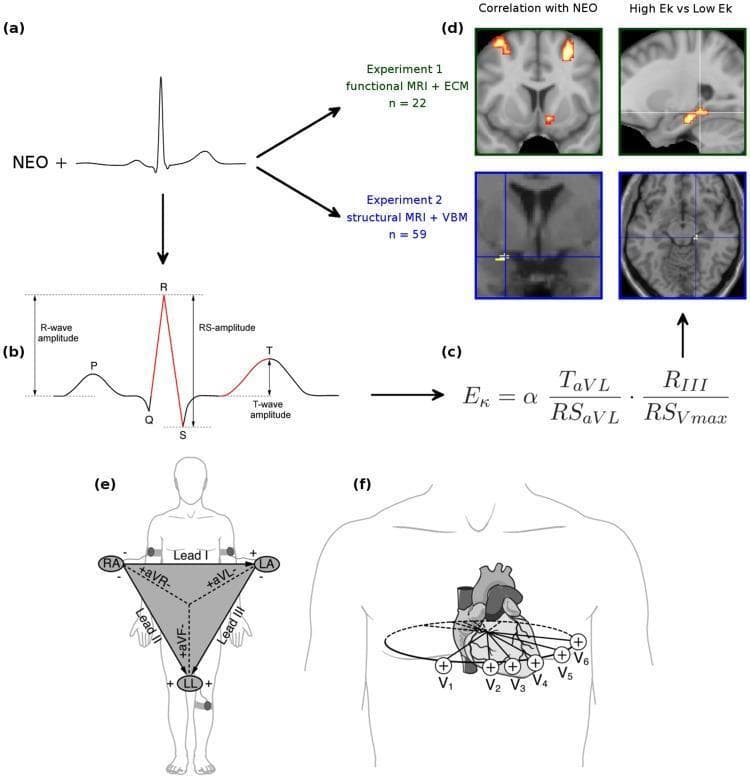 This composite educational infographic illustrates the methodology for correlating cardiac electrophysiology with neuroimaging. Panel (b) features a detailed ECG waveform diagram labeling the P-wave, QRS complex, and T-wave. It highlights measurement parameters including R-wave amplitude (baseline to peak), RS-amplitude (R-peak to S-nadir), and T-wave amplitude (plateau to peak). Panel (c) shows a mathematical formula for 'Ek', a cardiac amplitude signature derived from specific leads (aVL, III, and Vmax). Panels (e) and (f) depict standard 12-lead ECG electrode placement: the frontal plane limb leads (I, II, III, aVR, aVL, aVF) are arranged in Einthoven’s Triangle, while the horizontal plane precordial leads (V1-V6) are shown oriented across the chest wall. Panel (d) displays functional and structural neuroimaging results, specifically Eigenvector Centrality Maps and Voxel-Based Morphometry, showing significant activity and structural volume differences in the hippocampal subiculum correlated with the Ek cardiac index. The content integrates cardiology, neuroimaging (fMRI/MRI), and psychology to explore biomarkers for emotional personality.
