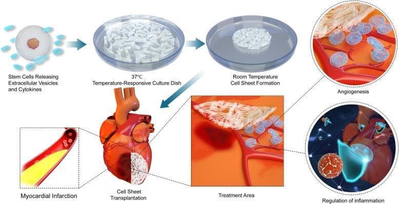 This pathophysiology diagram illustrates the process of cell sheet engineering for myocardial repair in ischemic heart disease. The multi-stage flowchart begins with stem cells releasing extracellular vesicles and cytokines. These cells are cultivated in a 37°C temperature-responsive culture dish, transitioning to room temperature to facilitate cell sheet formation. The resulting biological scaffold is then transplanted onto a heart with a white-shaded area representing myocardial infarction. Magnified 'Treatment Area' views detail the therapeutic mechanisms: Angiogenesis, showing the interaction between the fibrous cell sheet, transparent vesicles/cells, and the underlying vasculature; and Regulation of Inflammation, depicting immune cells and molecular signaling at the transplant site. This infographic summarizes stem cell-based regenerative therapy, focusing on paracrine signaling, tissue engineering, and vascularization strategies for treating damaged cardiac tissue.