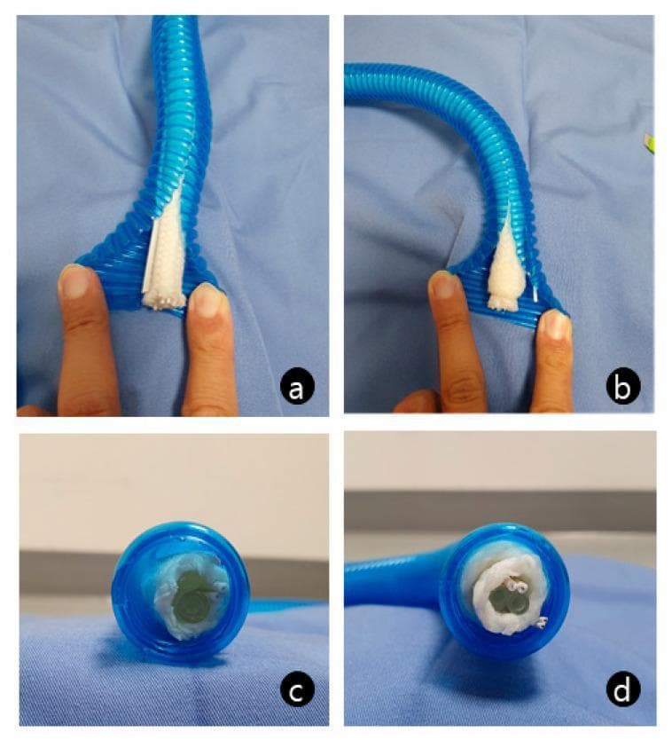 A comparison of a normal (a, c) and a defective (b, d) heated, humidified breathing circuit. The images show a corrugated, translucent blue plastic tube used in anesthesia and intensive care. Inside the circuit, an internal assembly containing a heating wire, temperature sensor, and fluid tubing is wrapped in a white cotton-like insulating material. In the normal circuit (a, c), the cotton wrapping is thin and uniform, preserving a clear patent lumen for airflow. In the obstructed circuit (b, d), which represents a manufacturing error, the white cotton material is irregularly thick and bulky, almost completely occluding the internal diameter of the tube. This visual demonstration highlights a critical equipment-related cause of difficult ventilation, where high circuit resistance due to internal lumen obstruction can lead to nearly undetectable end-tidal CO2 and low tidal volumes despite high pressure settings.