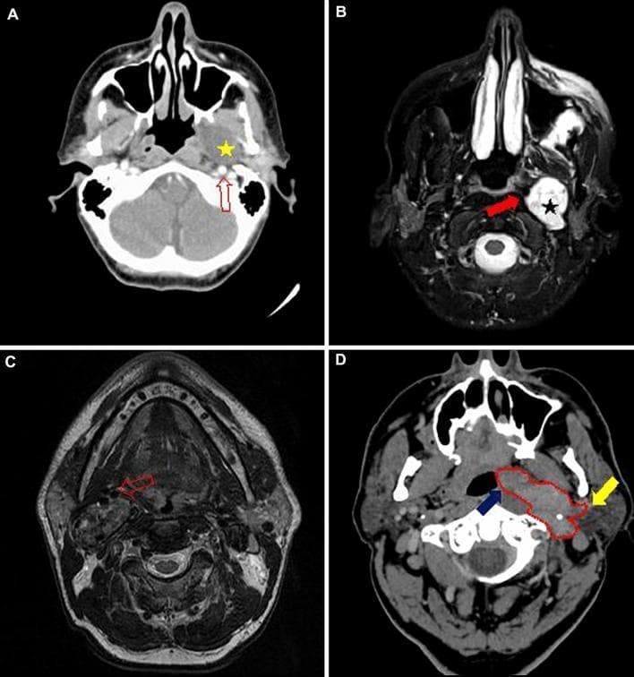 Hugging Face pmc clinical VQA raw