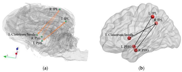 Comparative neuroanatomical diagram illustrating functional connectivity networks in the canine (a) and human (b) brains, specifically highlighting regions associated with familiarity and recollection judgments. Both panels use semi-transparent 3D brain renderings to display spatial relationships. In the dog brain (a), the network features connections between the bilateral inferior parietal regions (IPL), the bilateral pyriform cortex (Pyri), and the left claustrum/insula, represented by orange vectors. In the human brain (b), the homologous network connects the bilateral IPL, the bilateral parahippocampal gyrus (PHG), and the left claustrum/insula, represented by black vectors. The diagram illustrates how these specific regions of interest (ROIs) form functional circuits. The differences in anatomical distribution—such as the prominence of the pyriform cortex in the canine model versus the parahippocampal gyrus in the human model—highlight species-specific neurofunctional specializations. These diagrams are used in neuroimaging research to map behavioral changes to connectivity shifts within the fronto-parietal and limbic systems.