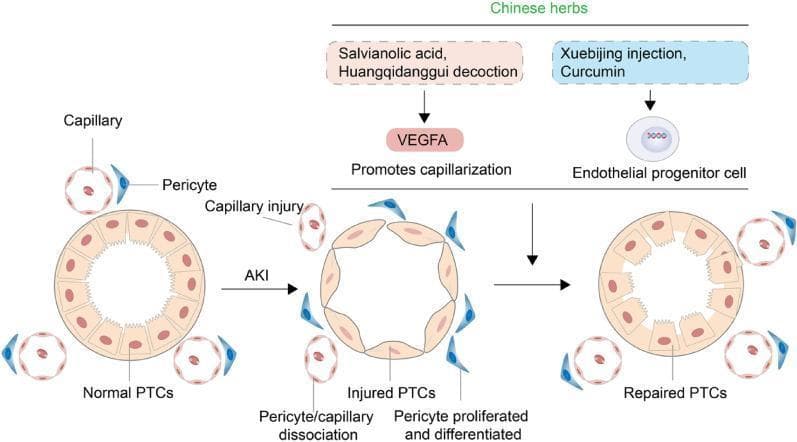 A pathophysiology diagram illustrating the progression of proximal tubular cell (PTC) morphology and vascular changes during Acute Kidney Injury (AKI) and subsequent repair mediated by Traditional Chinese Medicine (TCM). The diagram displays three states: 'Normal PTCs', 'Injured PTCs', and 'Repaired PTCs'. In the normal state, healthy cuboidal epithelial cells form the tubule, surrounded by intact capillaries and associated pericytes. Upon AKI, the PTCs flatten and thin, accompanied by capillary injury, pericyte-capillary dissociation, and pericyte proliferation/differentiation. The repair phase highlights two therapeutic pathways: 1) Salvianolic acid and Huangqidanggui decoction inducing VEGFA to promote capillarization, and 2) Xuebijing injection and Curcumin acting on endothelial progenitor cells. The final stage shows 'Repaired PTCs' where the tubular architecture is restored and capillary-pericyte density is increased. This diagram serves as an educational summary of renal vascular regeneration mechanisms and nephroprotective interventions.