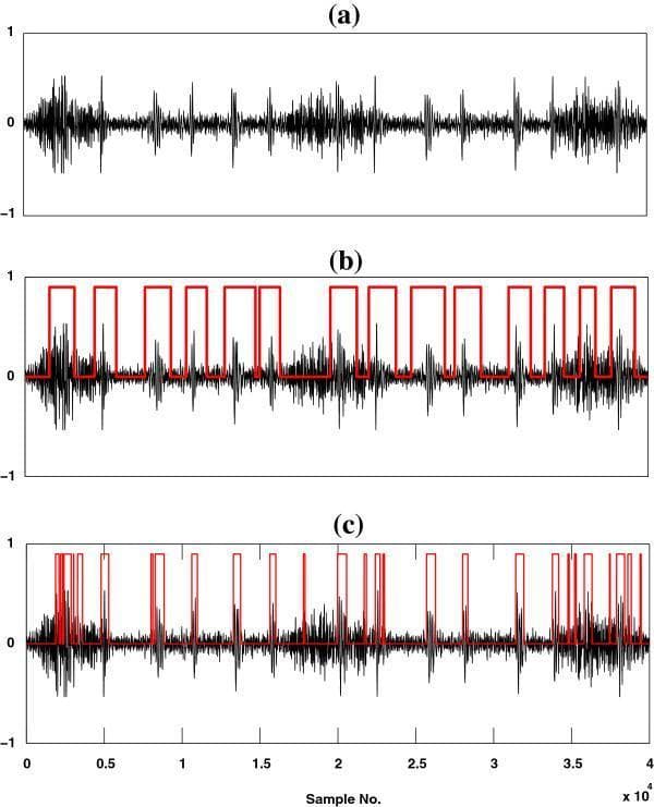 A comparison chart consisting of three time-domain waveforms (a, b, and c) illustrating heart sound (HS) localization within real recorded high-flow lung sound (LS) data. Subfigure (a) presents the raw acoustic signal, showing amplitude fluctuations with periodic bursts corresponding to mechanical cardiac events obscured by respiratory noise. Subfigures (b) and (c) demonstrate the performance of two different computational methods for identifying cardiac segments. The black waveforms represent the sound signal, while the overlaid red rectangular pulses indicate the identified temporal boundaries of heart sound components. Subfigure (b) shows the output of the HHA method, characterized by wider, continuous red blocks that capture the duration of heart sound complexes. Subfigure (c) displays the result of the SSA method, showing fragmented, narrower red pulses that often miss segments or produce discontinuous localization. This clinical signal processing diagram is used in cardiology and pulmonology research to evaluate algorithms for separating cardiac and respiratory sounds in auscultation data.