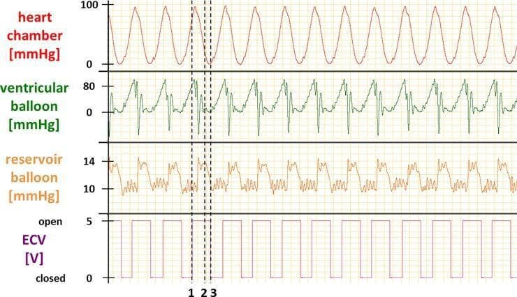 A multi-panel line graph illustrating the physiological mechanics of an in vitro cardiac loading device (CLD) used to simulate ventricular pressure-volume relationships. The visualization consists of four vertically aligned time-series plots depicting a cyclical cardiac simulator test. The top panel shows heart chamber pressure oscillating between 0 and 100 mmHg. The second panel displays ventricular balloon (VB) pressure, reaching peaks of approximately 80 mmHg. The third panel tracks reservoir balloon (RB) pressure, which fluctuates between 10 and 14 mmHg. The bottom panel indicates the status of an electronic check valve (ECV) as a binary voltage (0V for closed, 5V for open). Vertical dashed lines (labeled 1, 2, and 3) correlate specific phases: (1) ECV opening when VB pressure exceeds afterload, leading to VB emptying and RB filling; (2) VB refilling when VB pressure drops below RB pressure; and (3) ECV closure upon completion of refilling. This diagram is utilized in cardiovascular physiology research to validate cardiac cycle simulation for isolated heart preparations.