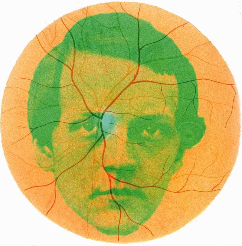 This educational illustration provides a historical and conceptual representation of the human fundus as seen through an early ophthalmoscope. The image features a circular field depicting a stylized retinal fundus with an orange-toned background and a radiating network of retinal vasculature. The vessels, rendered in varying shades of reddish-brown and dark brown, originate from a central anatomical focal point—the optic disc—which is highlighted by a distinct bluish-green hue. The branching pattern demonstrates the distribution of primary retinal arteries and veins across the posterior pole. Overlaid onto the anatomical features is a green silhouette portrait of Hermann von Helmholtz, the inventor of the ophthalmoscope, symbolizing the intersection of physiological optics and clinical examination. This comparison chart-style graphic illustrates the fundamental topography of the healthy retina, including the optic nerve head and the vascular arcades, serving as a pedagogical tool for understanding the history of ophthalmology and the basic landmarks of fundoscopy.