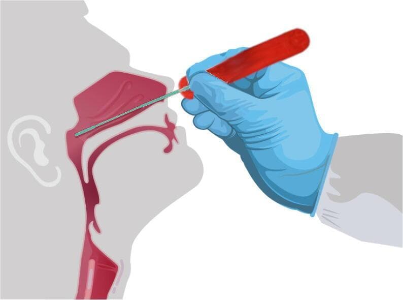 This medical illustration demonstrates the correct clinical procedure for nasopharyngeal swab insertion. The image features a sagittal cross-section of a human head, highlighting the nasal cavity, hard palate, and nasopharynx. A clinician's hand, wearing a blue medical glove, is shown manipulating a 3D-printed red press-fit handle attached to a semi-flexible nasopharyngeal swab. The swab is inserted through the naris, following a trajectory parallel to the nasal floor and palate rather than upwards toward the bridge of the nose. The tip of the swab is positioned deep within the nasopharynx, at the back of the nasal passage, to reach the site for respiratory specimen collection. The illustration serves as a pedagogical guide for healthcare professionals to visualize the anatomical pathway and depth required to reach the nasopharyngeal mucosa for diagnostic testing, such as for viral pathogens.
