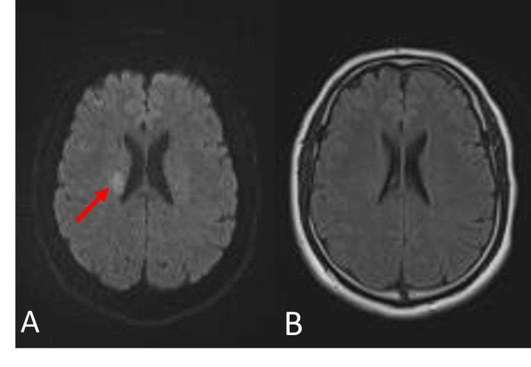 Hugging Face pmc clinical VQA raw