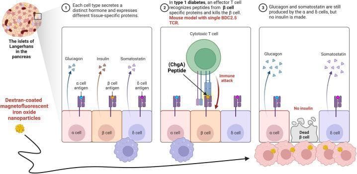 This pathophysiology diagram illustrates the cellular mechanisms of Type 1 Diabetes (T1D) within a pancreatic islet of Langerhans. The diagram is divided into three sequential panels. Panel 1 shows healthy endocrine cells: alpha (α) cells secreting glucagon, beta (β) cells secreting insulin, and delta (δ) cells secreting somatostatin, each expressing specific surface antigens. Panel 2 depicts an 'immune attack' phase where an autoreactive cytotoxic T cell recognizes a Chromogranin A (ChgA) peptide presented on the β-cell surface. Panel 3 illustrates the outcome: selective β-cell destruction ('Dead β cell') and the absence of insulin production, while α and δ cells remain intact and functional. The diagram also highlights the role of diagnostics, showing dextran-coated magnetofluorescent iron oxide nanoparticles being internalized by infiltrating macrophages and monocytes (insulitis). These nanoparticles serve as contrast agents for MRI to visualize microvascular leakage and inflammation in the pancreas. This educational tool demonstrates the transition from normal hormonal homeostasis to autoimmune-mediated islet dysfunction.