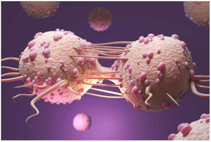 This medical illustration depicts a pathophysiology diagram of a tumor cell in the process of division, illustrating the concept of abnormal cellular proliferation. The central focus is on two large, beige-colored spherical structures connected by a cytoplasmic bridge and multiple fibrous strands, suggesting late-stage cytokinesis or mitotic activity. The cell membranes are textured with numerous small, pinkish, raised protuberances and elongated, pili-like extrusions, which may represent surface receptors, adhesion molecules, or signaling proteins common in malignant cells. In the background, smaller detached spherical entities with similar morphology are visible, scattered across a uniform purple field. This visual serves as an educational tool for oncology and cell biology, demonstrating the morphological characteristics of tumor growth and the physical mechanisms of cancer cell multiplication. The image provides a conceptual visualization often used to explain how a mass of tissues expands through continuous, dysregulated cellular division.