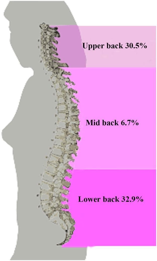 This infographic presents a medical diagram focused on the epidemiology of spinal pain. It features a lateral silhouette of a female human body in gray, with a detailed anatomical rendering of the vertebral column in a sagittal view. The diagram is partitioned into three distinct color-coded horizontal regions overlaid on the back to demonstrate the baseline prevalence of regional back pain. The upper back region, corresponding to the cervical and upper thoracic spine, indicates a prevalence of 30.5%. The mid-back region, covering the middle to lower thoracic vertebrae, shows a significantly lower prevalence of 6.7%. The lower back region, encompassing the lumbar and sacral spine, shows the highest prevalence at 32.9%. The visual educational focus is to illustrate the anatomical distribution and clinical frequency of back pain across the different segments of the spine, highlighting the high incidence of lower back pain (LBP) compared to other spinal regions.