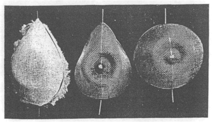 This historical clinical image, originally published in 1923, depicts three variations of ether masks used in early 20th-century anesthesia. The masks are shown in a comparison layout, illustrating the evolution of anesthetic equipment. The left-most mask has a pear-like, teardrop shape with a visible fibrous, lint-like texture along its lateral margins, suggesting a primitive design for holding liquid ether. The middle mask demonstrates an 'improved' teardrop design attributed to S.R. Wilson, featuring a more structured wire mesh or woven lattice with concentric rings and a central depression to facilitate even vapor distribution. The right-most mask is a circular variant with a similar fine-mesh construction and a central indentation. Each device is mounted on a vertical handling rod. These masks represent the transition in clinical practice from simple gauze-and-frame methods to more engineered designs intended to optimize the concentration and delivery of volatile anesthetic agents like ether and chloroform. This visual is significant for medical history and the study of the development of the specialty of anesthesiology.