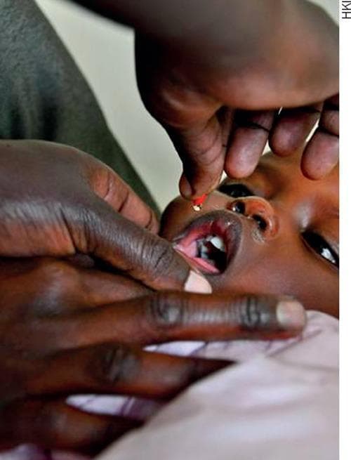 This clinical photograph demonstrates the oral administration of high-dose vitamin A supplementation to a pediatric patient. The image shows an adult health worker or caregiver using a manual technique to ensure safe delivery: one hand gently stabilizes the child's jaw and depresses the lower lip to keep the mouth open, while the other hand squeezes a small capsule or dispenser. A single, translucent red droplet of the liquid supplement is captured in mid-air, directed toward the child's open mouth. The child, appearing to be an infant or toddler, has their mouth open wide, revealing the tongue and primary dentition. This visual illustrates a common public health intervention used in nutritional programs to prevent vitamin A deficiency (VAD) and its associated complications, such as xerophthalmia and increased susceptibility to infections. The focus is on the practical application and administration technique within a community health or pediatric clinical setting.