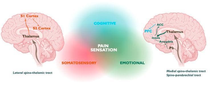 This medical illustration depicts the ascending neuroanatomical pathways for pain perception in the human brain, categorized into three functional domains: Somatosensory (red), Emotional (green), and Cognitive (cyan). Two sagittal brain diagrams flank a central 'PAIN SENSATION' Venn-style diagram. The left diagram illustrates the Lateral Spino-thalamic tract, showing nociceptive signals ascending through the thalamus to the primary (S1) and secondary (S2) somatosensory cortices. The right diagram depicts the Medial Spino-thalamic and Spino-parabrachial tracts. These pathways transmit signals from the parabrachial nucleus (Pb) and thalamus to the amygdala, insula, anterior cingulate cortex (ACC), and prefrontal cortex (PFC). Arrows represent the directional flow of neural information, highlighting the multi-dimensional nature of pain processing. This visual is designed for advanced medical education in neurology and pain management, emphasizing the distinction between sensory-discriminative and affective-cognitive processing components of the pain matrix.