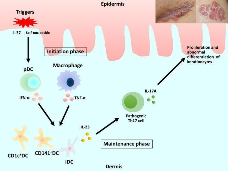 A multi-modal educational graphic combining clinical photographs and a pathophysiology diagram illustrating the pathogenesis of psoriasis. In the top right corner, two clinical photographs demonstrate erythematous, scaly plaques characteristic of psoriasis. The central diagram maps the immunological cascade across the epidermis and dermis. An 'Initiation phase' begins with triggers such as LL37 and self-nucleotides, which activate plasmacytoid dendritic cells (pDC) and macrophages in the dermis to release IFN-α and TNF-α. These cytokines stimulate conventional and inflammatory dendritic cells (CD1c+DC, CD141+DC, and iDC) to produce IL-23. In the 'Maintenance phase,' IL-23 promotes the differentiation and activity of pathogenic Th17 cells. These cells release IL-17A, which acts back upon the epidermis to drive the proliferation and abnormal differentiation of keratinocytes, creating a feed-forward inflammatory loop. The diagram utilizes distinct icons for cytokines and cell types to represent complex neuro-immunological interactions.