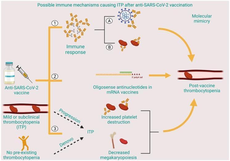 A pathophysiology diagram illustrating three proposed immune mechanisms linking anti-SARS-CoV-2 vaccination to immune thrombocytopenic purpura (ITP). Pathway 1 outlines an immune response where antibodies generated against the SARS-CoV-2 spike protein (A) cross-react with platelet antigens (B) through molecular mimicry, leading to thrombocytopenia. Pathway 2 depicts the potential role of oligosense antinucleotides in mRNA vaccines, identified by an RNA sequence with a 3' polyA tail, which can directly cause post-vaccine thrombocytopenia. Pathway 3 illustrates the development of ITP through two clinical scenarios: the progression of pre-existing mild/subclinical ITP or de novo development in patients with no prior history. These clinical pathways converge on two cellular mechanisms: increased peripheral platelet destruction by antibodies and decreased megakaryopoiesis within the bone marrow. The final common outcome across all pathways is post-vaccine thrombocytopenia within the vasculature. This medical illustration is intended for educational purposes regarding hematological adverse events and vaccine-related autoimmunity.