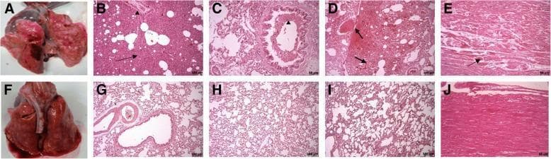 A comparison of macroscopic and histopathological findings in an animal model of acute respiratory distress syndrome (ARDS) across control (A-E) and treatment (F-J) groups. Macroscopic images A and F show excised lung tissue; the control lung (A) displays severe hyperemia, hemorrhage, and edema, while the treatment lung (F) shows minimal hyperemia. Light microscopy images (H&E stain) further illustrate pathological differences. In the control group, lung sections (B, C, D) reveal severe interstitial pneumonia, extensive inflammatory cell infiltration (arrowheads), and intra-alveolar hemorrhage (arrows). Cardiac section E shows localized myofibrillar necrosis (arrow). Conversely, the treatment group (G, H, I) demonstrates significant preservation of lung architecture with reduced cellular infiltration and approximately normal alveolar septa. The cardiac section (J) shows healthy myocardium without necrosis. This visual serves as a comparative study on the efficacy of therapeutic interventions, such as mesenchymal stem cells, in mitigating organ damage associated with inflammatory lung injury.