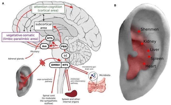 This medical illustration depicts the mechanisms and pathways of transcutaneous auricular vagus nerve stimulation (taVNS) in relation to mental health and systemic inflammation. Part A is a pathophysiology diagram showing a sagittal view of the brain and its connections to the ear and peripheral organs. It illustrates neural pathways starting from the auricular branch of the vagus nerve, projecting to the nucleus tractus solitarius (NTS) and dorsal motor nucleus of the vagus nerve (DMNV). Ascending pathways are shown reaching the locus coeruleus (LC), parabrachial nucleus (PBN), amygdala (Am), hypothalamus (HTh), and cortical areas involved in attention-cognition and vegetative-somatic functions. Efferent pathways highlight the 'cholinergic anti-inflammatory pathway' to the spleen and the 'microbiome-gut-brain axis.' Part B is an anatomical diagram of the external ear (auricle) identifying specific acupuncture points (Shenmen, Kidney, Liver, Spleen, Heart) within the vagus nerve distribution zone. The content integrates concepts from neurobiology, immunology, and integrative medicine, specifically focusing on the treatment of depression through neuromodulation.
