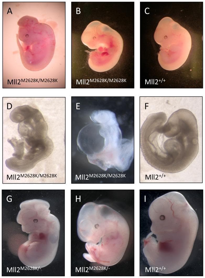 This composite of clinical photographs displays a side-by-side comparison of embryonic development in a mouse model, specifically examining the effects of the Mll2 M2628K mutation. The image is organized into three rows (A-C, D-F, G-I) comparing mutant (Mll2 M2628K/M2628K and Mll2 M2628K/-) embryos against wild-type (Mll2+/+) controls. Key developmental abnormalities in the mutants include exencephaly (protrusion of brain tissue due to neural tube defects), visible in panels A and G; severe pericardial oedema (fluid accumulation around the heart), prominent in B, E, and H; and abnormal heart looping and growth retardation shown in D and E. Panel E specifically illustrates anterior truncation defects at 9.5 dpc. In contrast, the wild-type embryos (C, F, I) demonstrate normal morphology, proper axial turning, and typical developmental progression for their respective stages (9.5 and 12.5 dpc). This figure serves as an educational tool for embryology and genetics, illustrating how specific genetic mutations disrupt midline development, cardiac morphogenesis, and neural tube closure.
