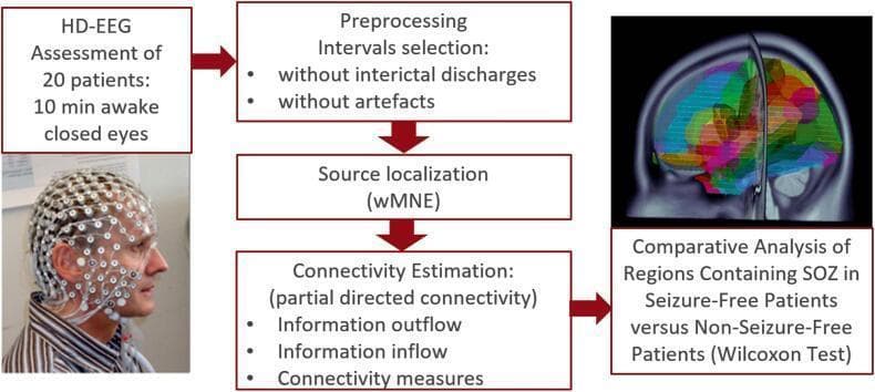 This infographic outlines a neurophysiological analysis strategy for epilepsy research. The flowchart begins with an HD-EEG assessment of 20 patients (10 minutes awake, eyes closed), accompanied by a clinical photograph showing a patient wearing a high-density EEG electrode cap. The process follows a stepwise algorithm: (1) Preprocessing to select intervals without interictal discharges or artifacts; (2) Source localization using weighted Minimum Norm Estimation (wMNE); and (3) Connectivity Estimation focused on partial directed connectivity, specifically information inflow, outflow, and general connectivity measures. The final step is a Comparative Analysis of regions containing the Seizure Onset Zone (SOZ) between seizure-free and non-seizure-free patients using the Wilcoxon Test. This is visually represented by a sagittal diagnostic image of a human brain with a multi-colored cortical segmentation overlay, illustrating anatomical regions of interest. The diagram serves as an educational tool for understanding the diagnostic and analytical pipeline used to predict surgical outcomes based on brain network connectivity in epilepsy patients.
